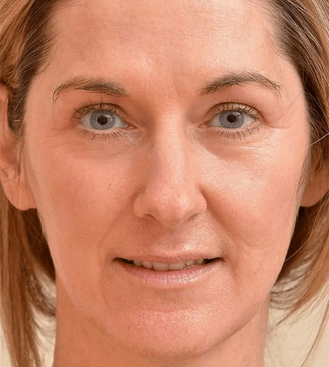 I look younger after applying Eudalie cream