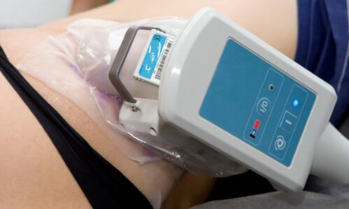 Cryolipolysis for body skin